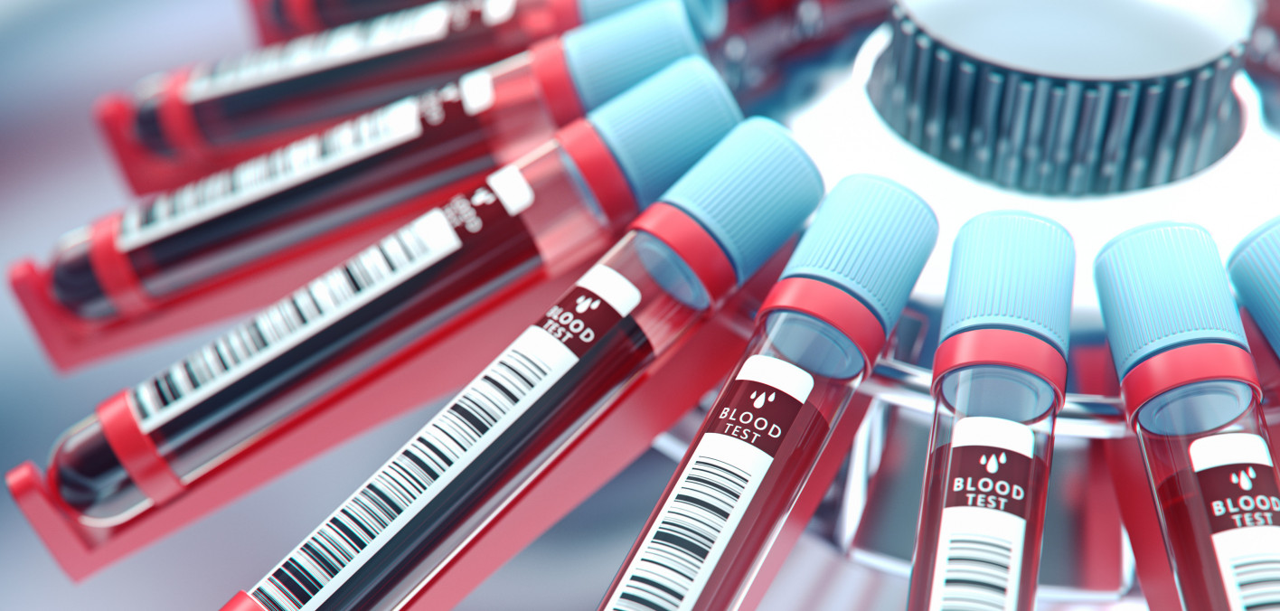 Blood Test for MultiCancer Screening Has Impressive Success Rate