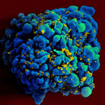 NIAID HIV-infected H9 T cell  Scanning electromicrograph of an HIV-infected H9 T cell.