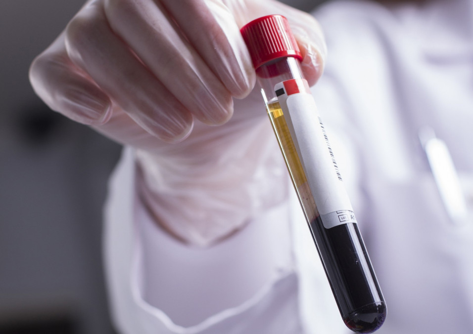 New Blood Test for Colorectal Cancer Found Effective Cancer Health