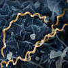 Colorized electron micrograph of Treponema pallidum, the bacteria that cause syphilis. Several spiral-shaped bacteria have been highlighted in gold.
