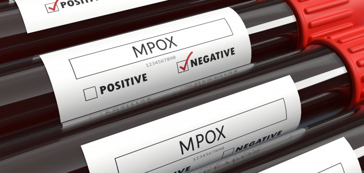 monkey pox mpox test tubes
