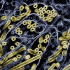 Colorized transmission electron micrograph of avian influenza A H5N1 virus particles (gold) grown in epithelial cells.Colorized transmission electron micrograph of avian influenza A H5N1 virus particles (gold) grown in epithelial cells.