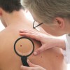 Skin cancer examination