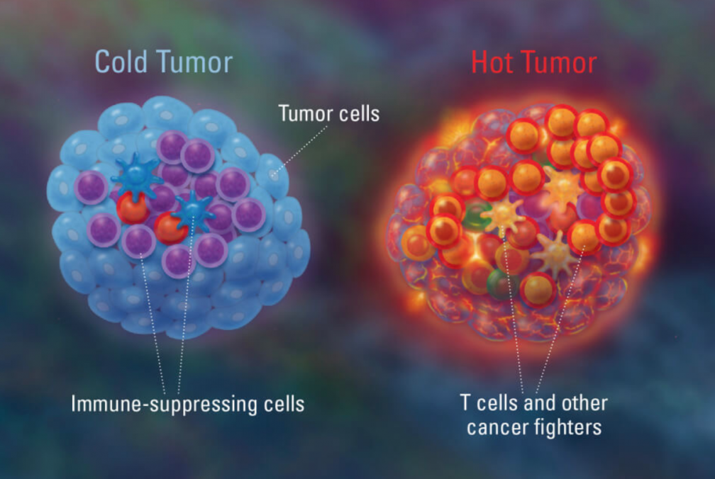 Enhancing Immunotherapy The Race to Make ‘Cold’ Tumors ‘Hot’ Cancer