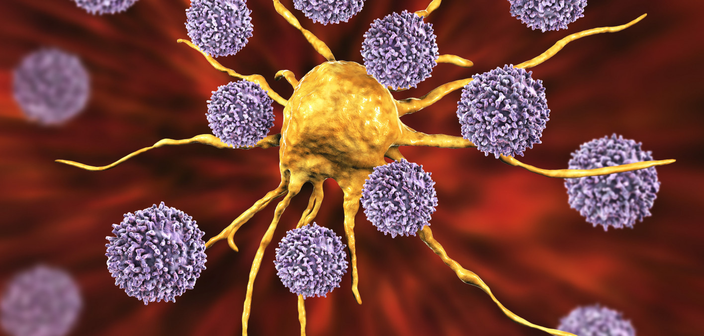 People With HIV Are Increasingly Diagnosed With Cancer for a Second