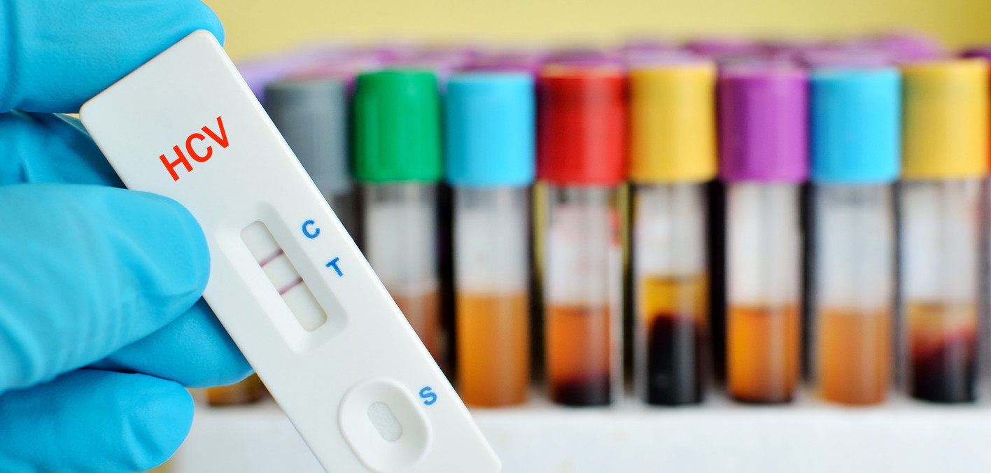 Although my hepatitis C is gone, I still have antibodies. Does this