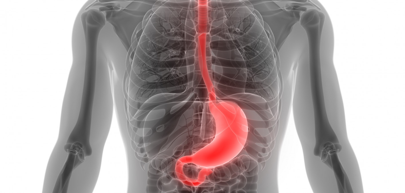Some Cancers of the Stomach and Esophagus Are More Common in People